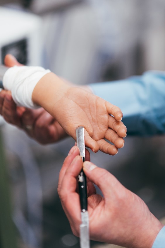 Prothesemakers in Zwolle | Fotografie: Marjon Lukje